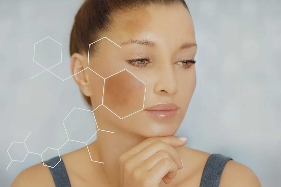 Best Creams for Melasma