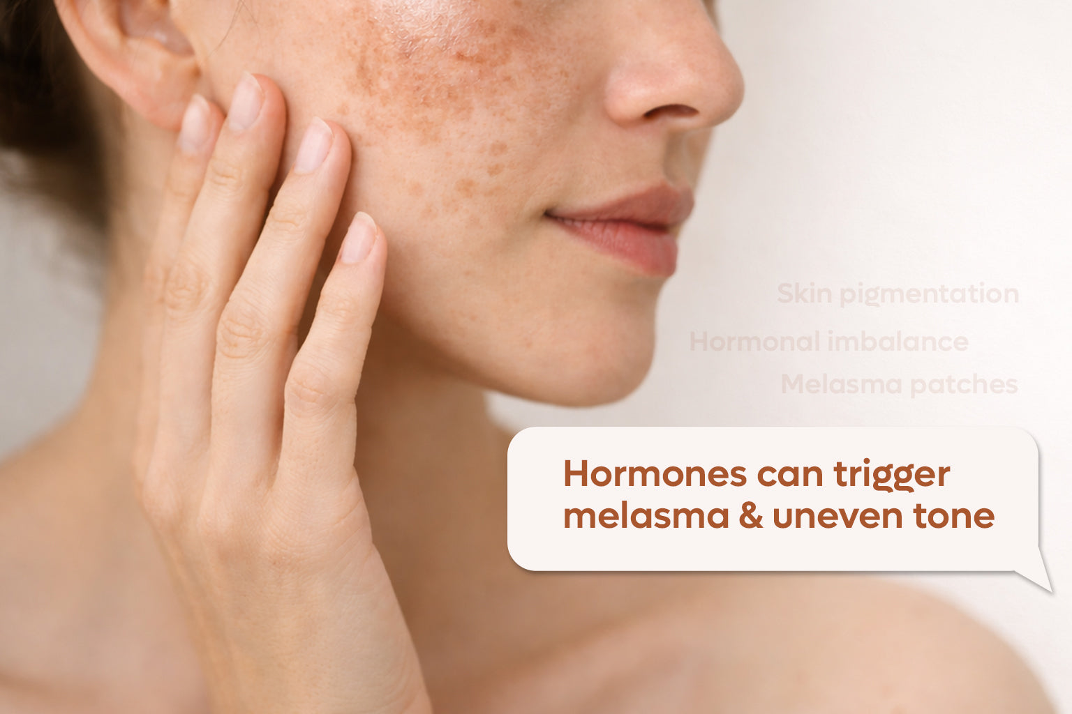 How Hormonal Changes Cause Uneven Skin Tone and Melasma