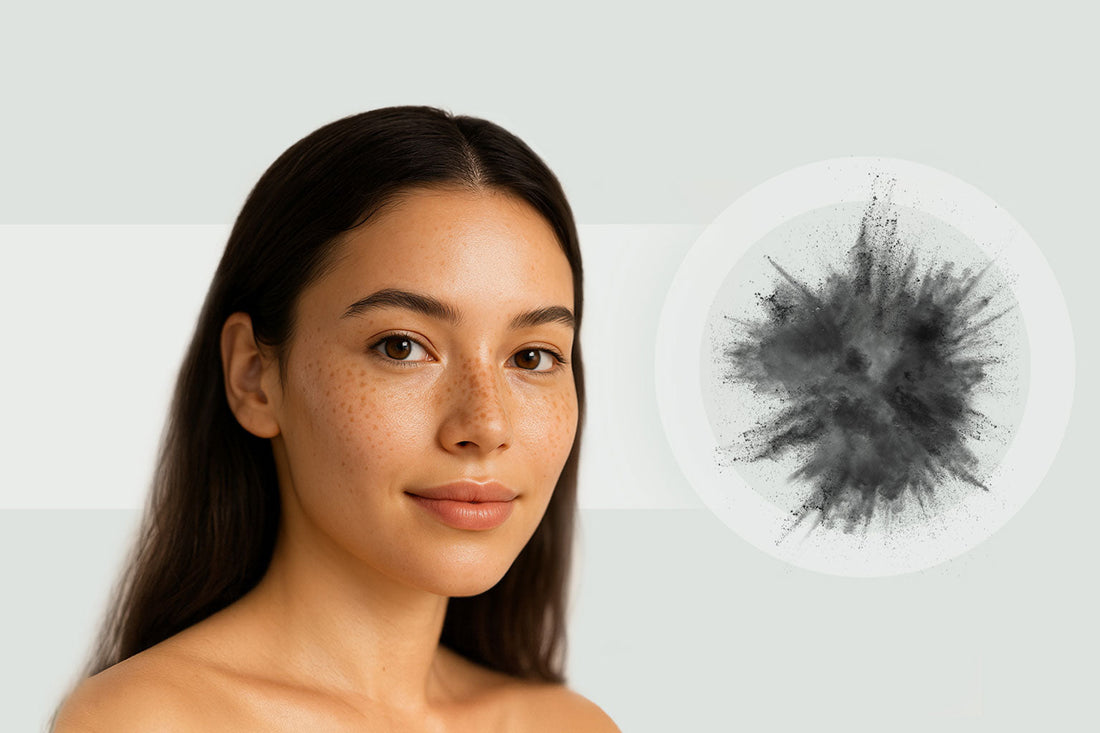 Why Do Freckles Appear