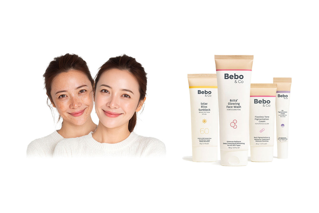 Complete Guide to Melasma, Freckles & Pigmentation